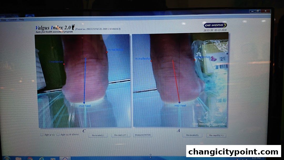 Computer screen displaying a foot analysis program by Dr. Kong.